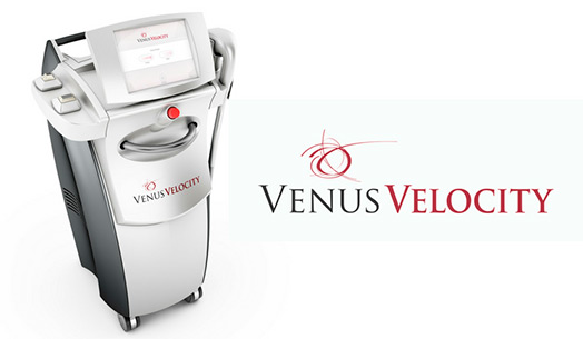 Venus Velocity